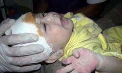 Suriyede 1 aylık bebek enkazdan sağ çıkarıldı